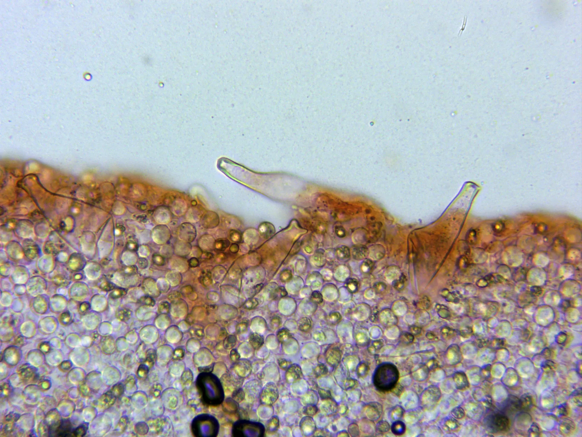 Microscopía de Pluteus salicinus - 10 - Arista x 400